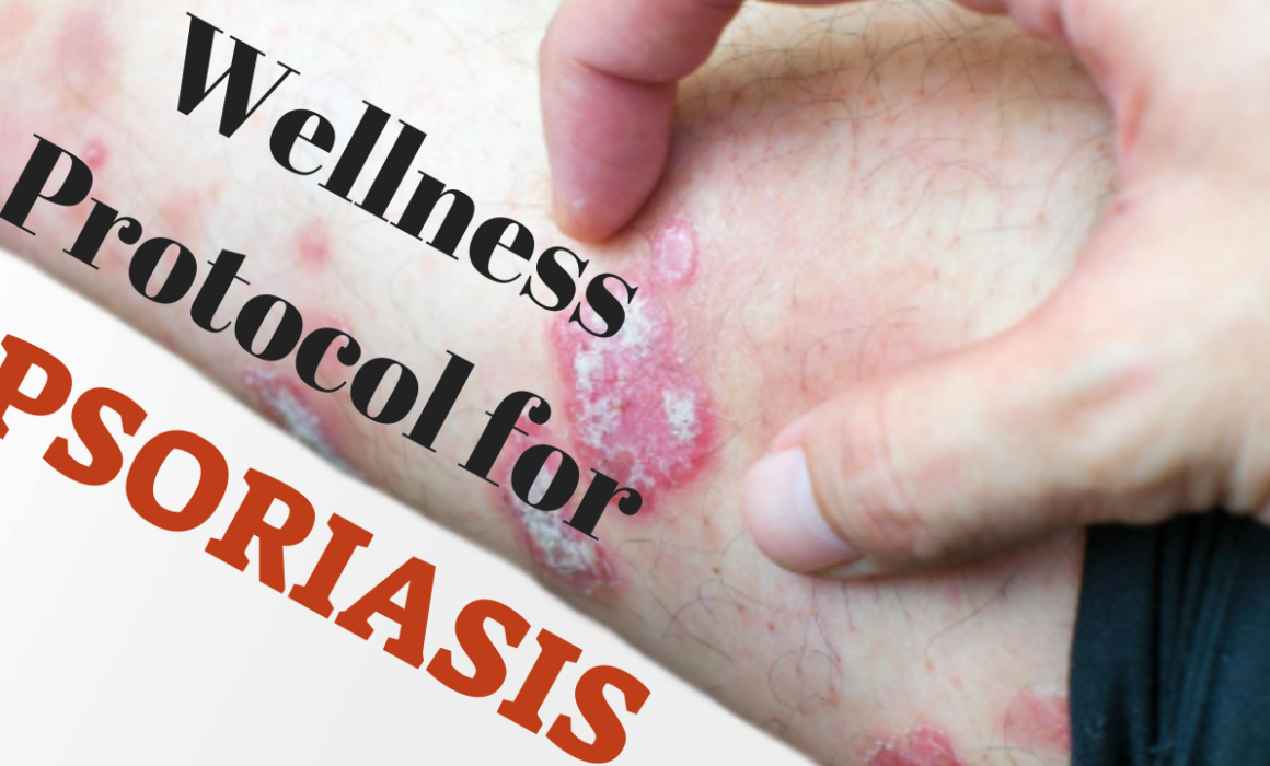 Wellness Plan for Psoriasis | Jovanka Ciares
